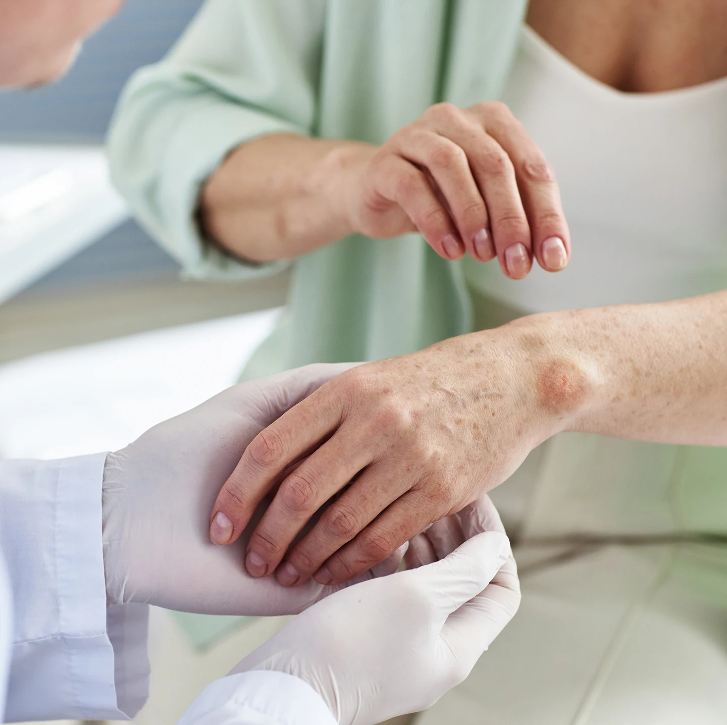 Medical Dermatology Services-image